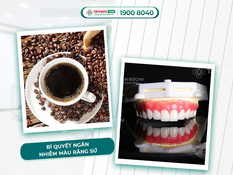 BỌC RĂNG SỨ CÓ UỐNG CÀ PHÊ ĐƯỢC KHÔNG? THỰC PHẨM NÊN VÀ KHÔNG NÊN DÙNG