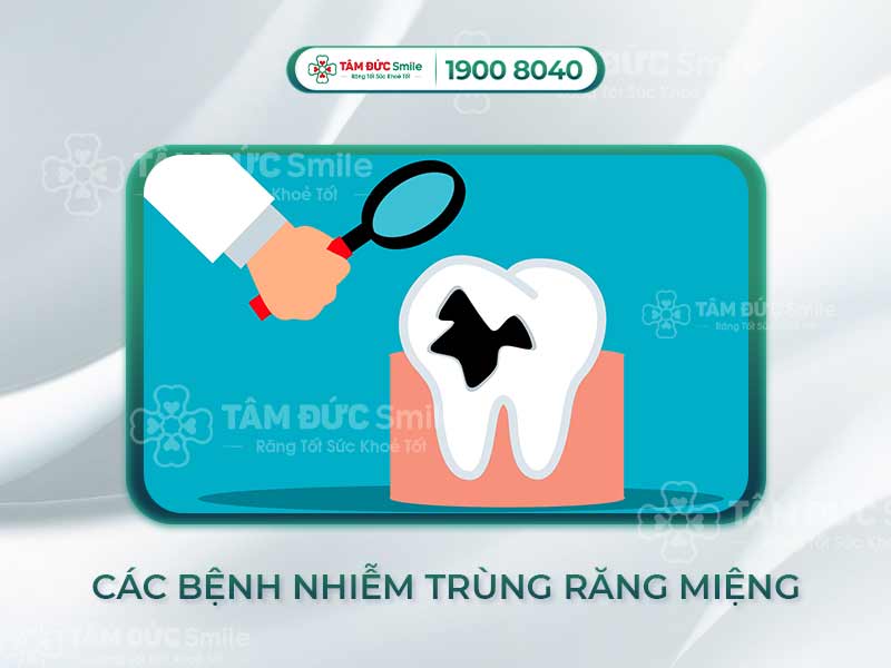 CÁC DẠNG NHIỄM TRÙNG RĂNG MIỆNG THƯỜNG GẶP, CÁCH KHẮC PHỤC VÀ PHÒNG NGỪA