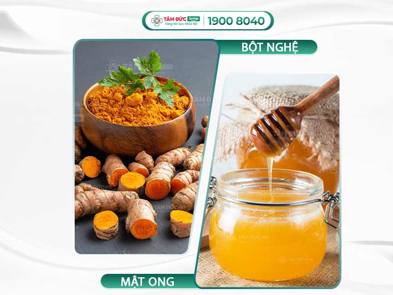 3+ CÁCH LÀM GIẢM SƯNG NƯỚU HIỆU QUẢ, DỄ THỰC HIỆN NGAY TẠI NHÀ