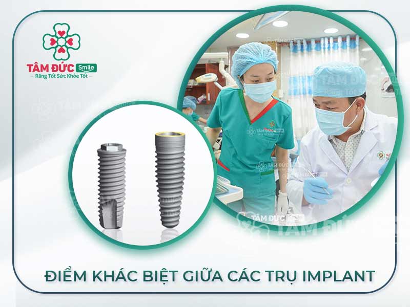 ĐIỂM KHÁC BIỆT GIỮA CÁC TRỤ IMPLANT HIỆN NAY