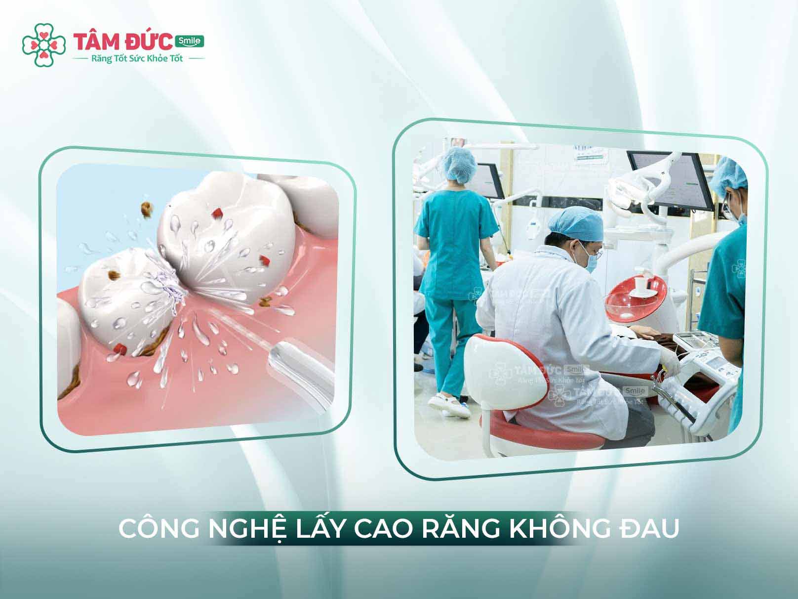 CẠO VÔI RĂNG CÓ ĐAU KHÔNG?