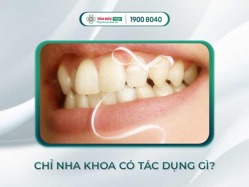 CHỈ NHA KHOA LÀ GÌ? LÀM THẾ NÀO ĐỂ SỬ DỤNG CHỈ NHA KHOA ĐÚNG CÁCH?