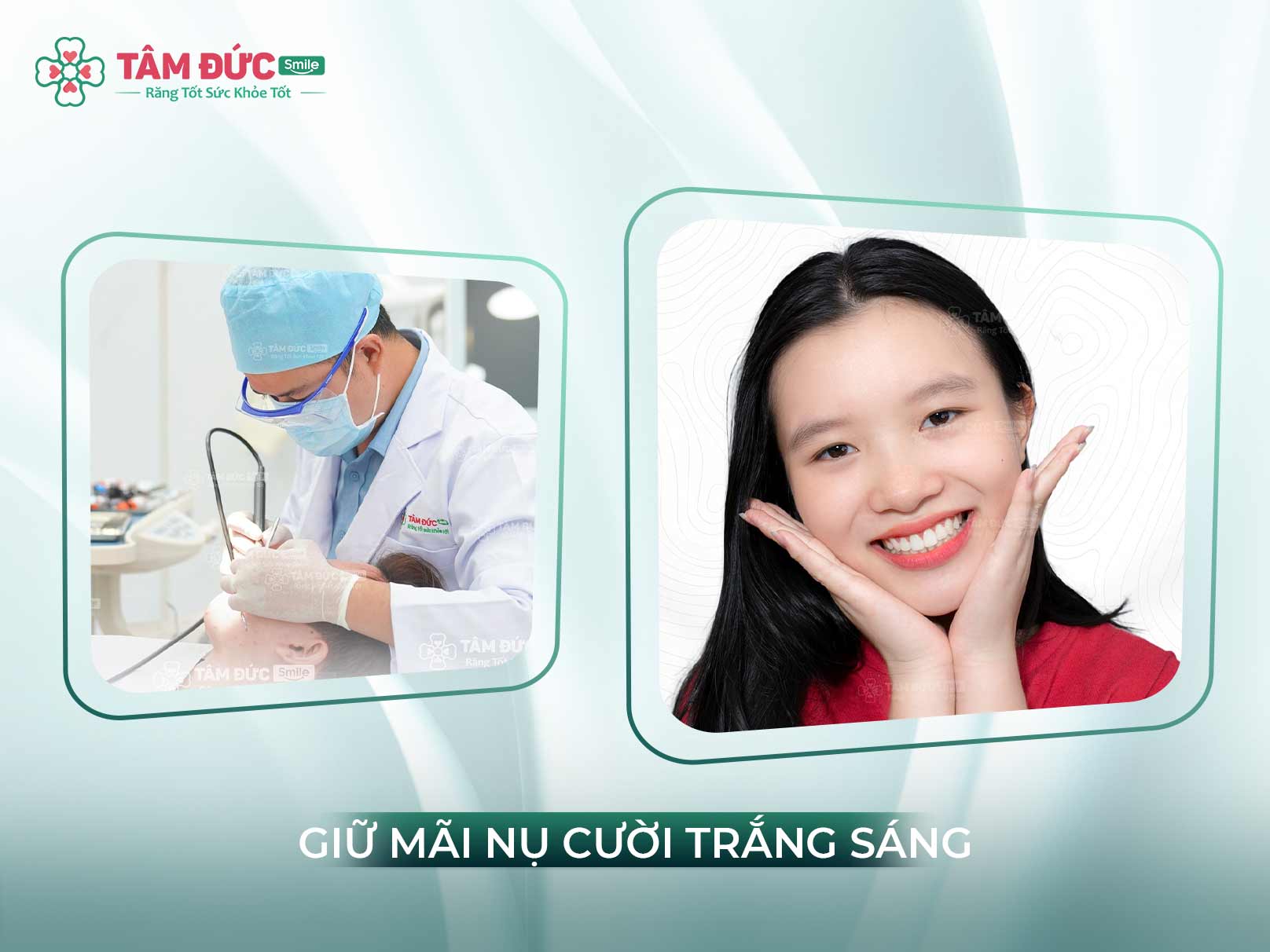 CÓ NÊN CẠO VÔI RĂNG HAY KHÔNG?