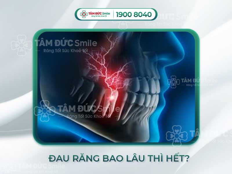 CƠN ĐAU RĂNG THƯỜNG KÉO DÀI BAO LÂU? 7 CÁCH LÀM DỊU CƠN ĐAU HIỆU QUẢ