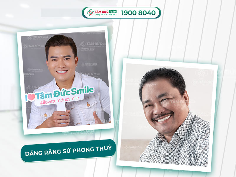 TOP 4 DÁNG RĂNG SỨ PHONG THUỶ NỔI TIẾNG ĐƯỢC NHIỀU SAO VIỆT LỰA CHỌN