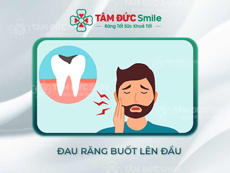 ĐAU RĂNG BUỐT LÊN ĐẦU CÓ NGUY HIỂM KHÔNG? CÁCH ĐIỀU TRỊ VÀ PHÒNG NGỪA