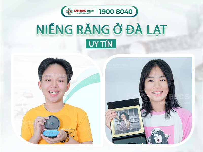 ĐỊA CHỈ NIỀNG RĂNG Ở ĐÀ LẠT UY TÍN, TRẢ GÓP 0% LÃI SUẤT, TRẢ TRƯỚC 1 TRIỆU ĐỒNG