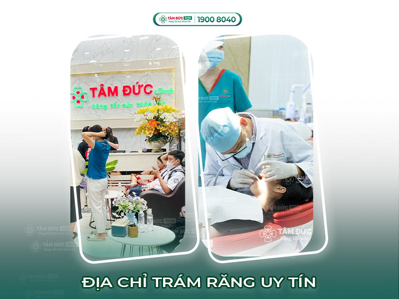 ĐỊA CHỈ TRÁM RĂNG THẨM MỸ Ở ĐÂU TỐT?