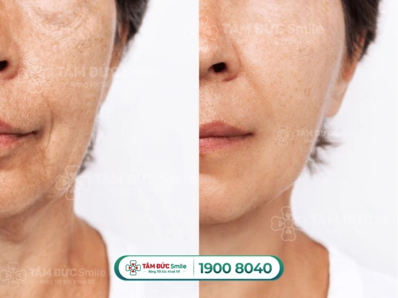 Dinh dưỡng trong giá đỗ