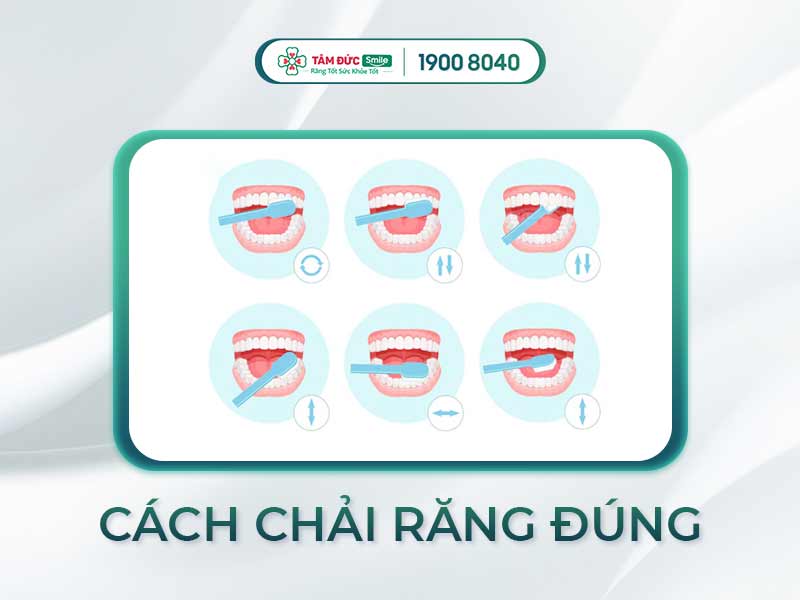[HƯỚNG DẪN] ĐÁNH RĂNG ĐÚNG CÁCH VỚI BÁC SĨ TẠI NHA KHOA TÂM ĐỨC SMILE