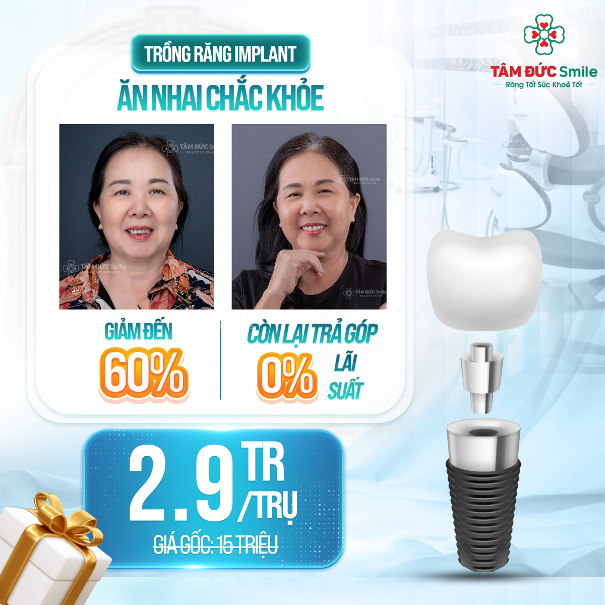 địa chỉ trồng răng implant uy tín đà nẵng
