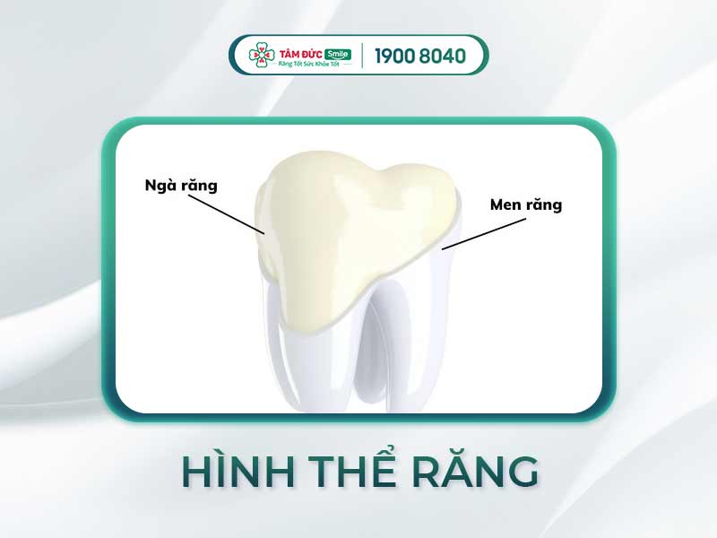 KHÁM PHÁ HÌNH THỂ RĂNG - LỢI ÍCH CỦA MỘT HÀM RĂNG CHUẨN