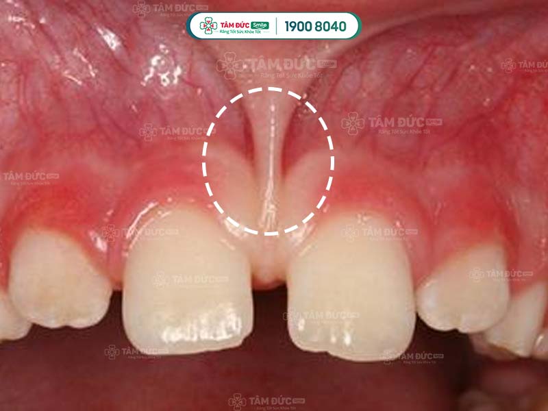 khoang miệng gồm những bộ phận nào