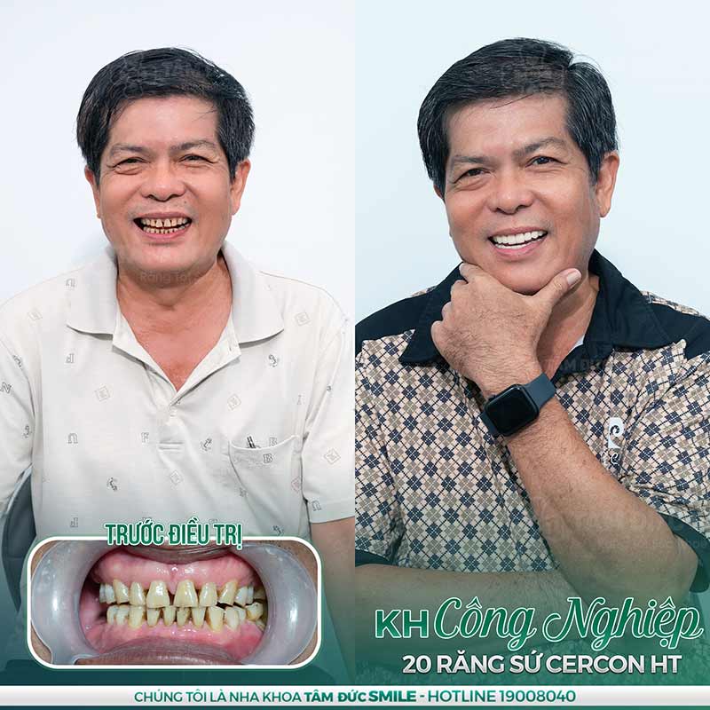 1 nụ cười bằng 10 thang thuốc bổ