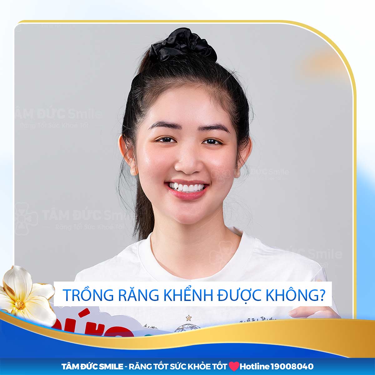 NHƯ THẾ NÀO LÀ TRỒNG RĂNG KHỂNH? 3 CÁCH LÀM RĂNG KHỂNH PHỔ BIẾN