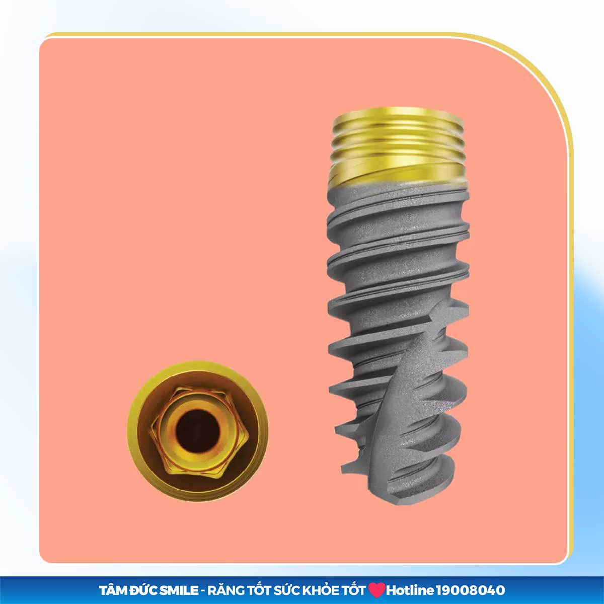 NOBEL ACTIVE TIULTRA - TRỤ IMPLANT VĨNH VIỄN 