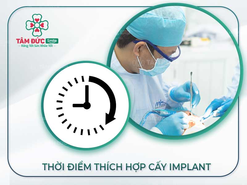 THỜI ĐIỂM VÀNG TRỒNG RĂNG IMPLANT KHÔNG NÊN BỎ LỠ GIÚP LÀNH THƯƠNG NHANH