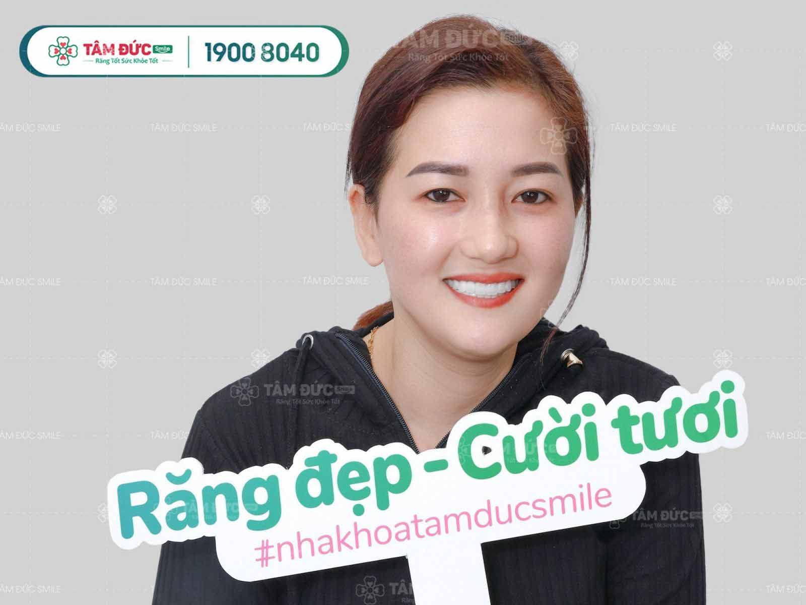 mẹo tẩy trắng răng tại nhà