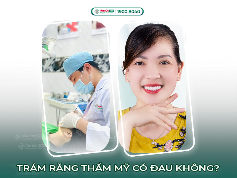 TRÁM RĂNG THẨM MỸ CÓ ĐAU HAY KHÔNG?