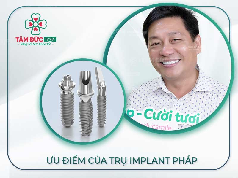 TRỤ IMPLANT PHÁP CÓ ƯU ĐIỂM GÌ? 9+ TRỤ IMPLANT TỐT TẠI NHA KHOA TÂM ĐỨC SMILE