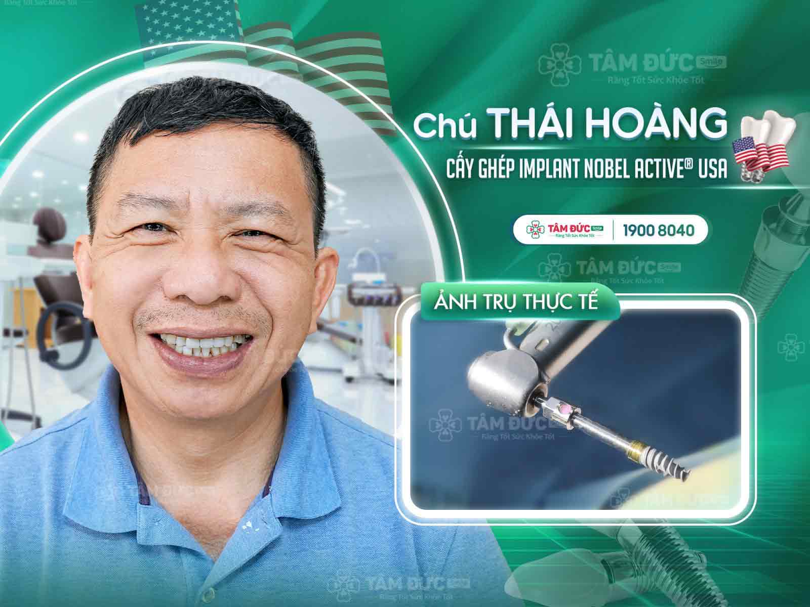 khách hàng cấy ghép Implant tại nha khoa Tâm Đức Smile